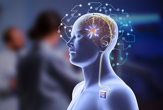 Precision Medicine : Caritas Hospital's DBS Therapy for Movement Disorders