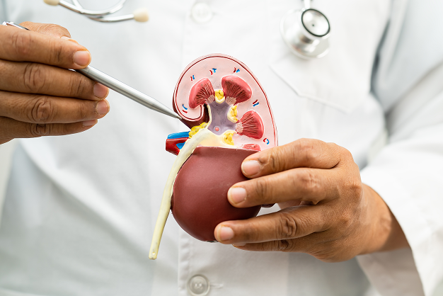 Kidney Transplantation: A Simple Guide – Caritas Hospital