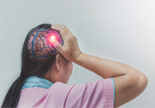 Unveiling the Silent Threat: Understanding Stroke