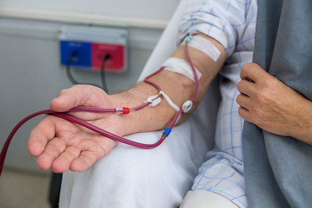 A-V Fistula & Hemodialysis: The Lifeline of  Kidney Patients