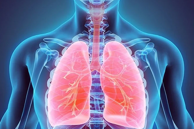 COPD