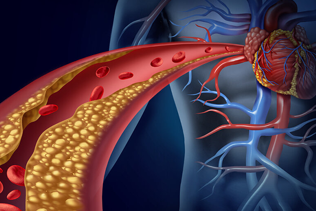 The Role of Cholesterol in Heart Health